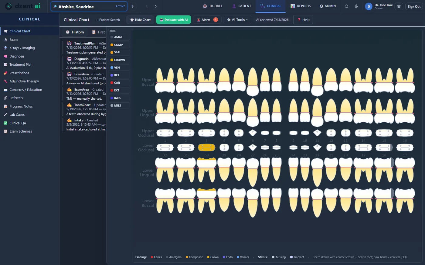 DzentAI clinical chart in the Dim theme — anatomical odontogram with a procedure palette and color-coded findings