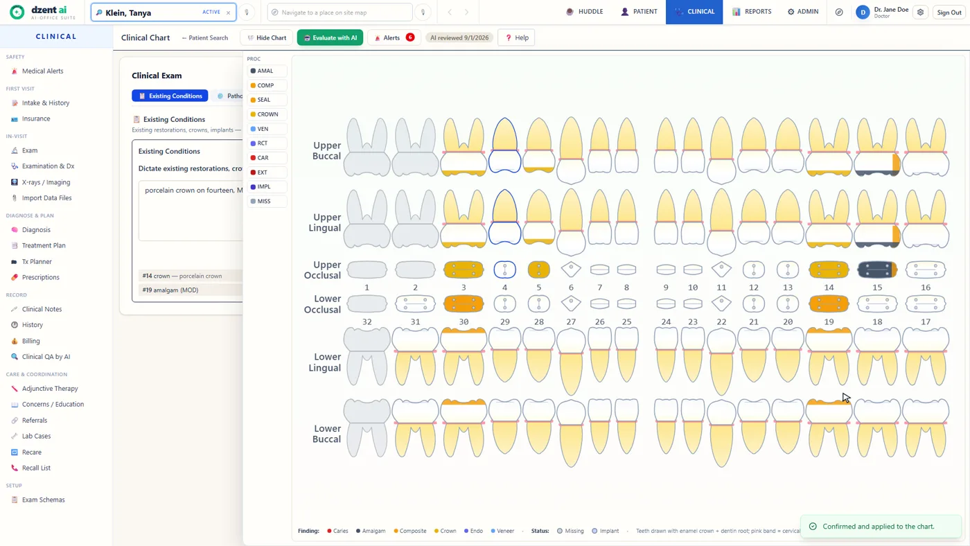 DzentAI clinical chart: a dictated finding — porcelain crown on fourteen — structured onto the anatomical odontogram, with 'Confirmed and applied to the chart'